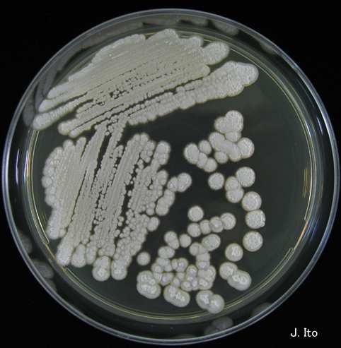 Trichosporon asahii kolonie bílé až krémové, povrch suchý sametový až škrobový s radiálními brázdami pučící blastokonidie chybí, tvoří arthrokonidie pozitivní ureáza