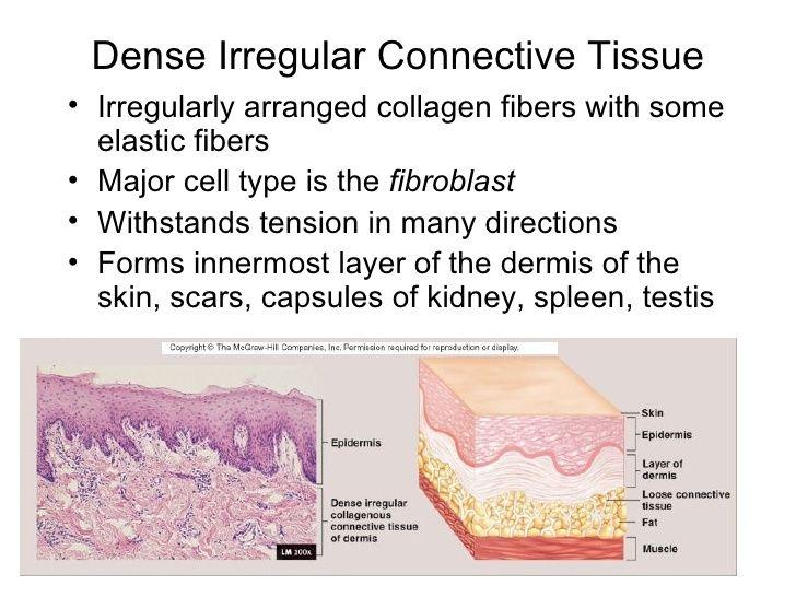 Tuhá neuspořádaná pojivová tkáň * Nepravidelně uspořádaná kolagenní vlákna s trochou elastických vláken * Hlavní buněčný typ-