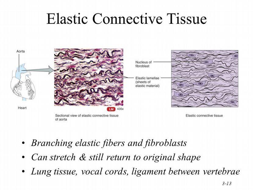Elastická pojivová tkáň Větvená elastická vlákna a fibroblasty Může se