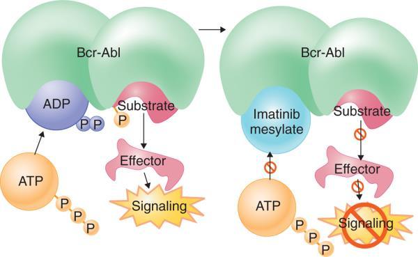 V léčbě CML v současné době hrají zásadní roli inhibitory tyrosinové kinasy (TKI).