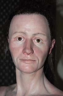 Datování obličejové deformity