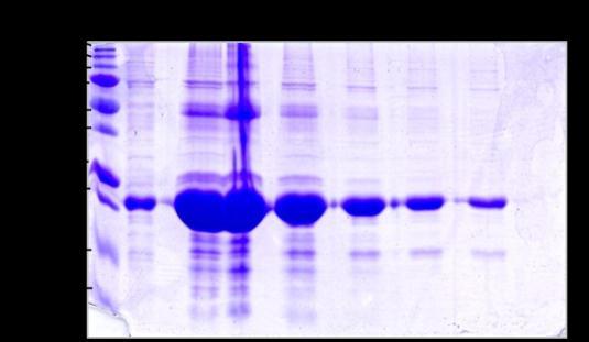 Niklová chelatační chromatografie: Tento purifikační krok byl proveden vsádkovou metodou (viz kapitola 4.3.4.). K promývání náplně kolony bylo použito 300 ml 10% (v/v) pufru F.