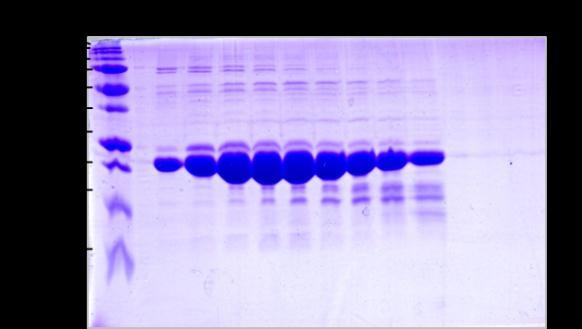Absorbance při 280 nm MKop S75 TH1R 17062010:10_UV MKop S75 TH1R 17062010:10_Fractions MKop S75 TH1R 17062010:10_Logbook mau 80 neagregovaný protein 60 40 agregovaný protein 20 0 A1 A2 A3 A4 A5 A6 A7