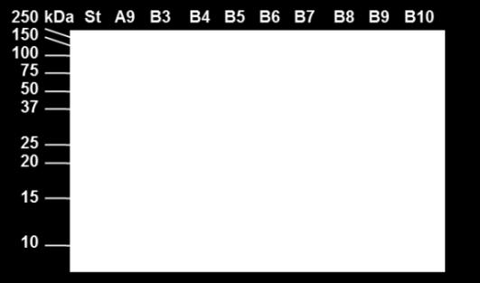 Absorbance při 280 nm MKop S200 TH1R 18032011a001:10_UV MKop S200 TH1R 18032011a001:10_Fractions MKop S200 TH1R 18032011a001:10_Logbook mau 35.0 30.0 25.0 20.0 15.0 10.0 5.0 0.