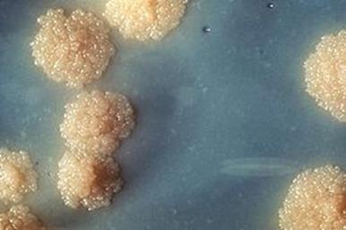 Latentní TB infekce- doutnající hrozba? LTBI je definována jako stav perzistující imunitní odpovědi na stimulaci antigeny M.
