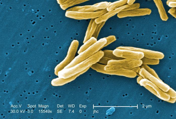 TB etiologie Obligátně patogenní mykobakterie Mycobacterium tuberculosis
