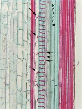 Xylém: Cévní elementy: Cell wall thickening kruhovité,