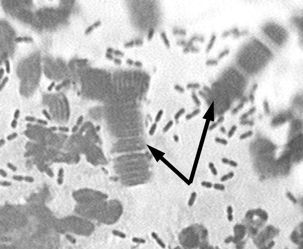 Cytologické vyšetření vzorků z BAL Bakterie Simonsiella