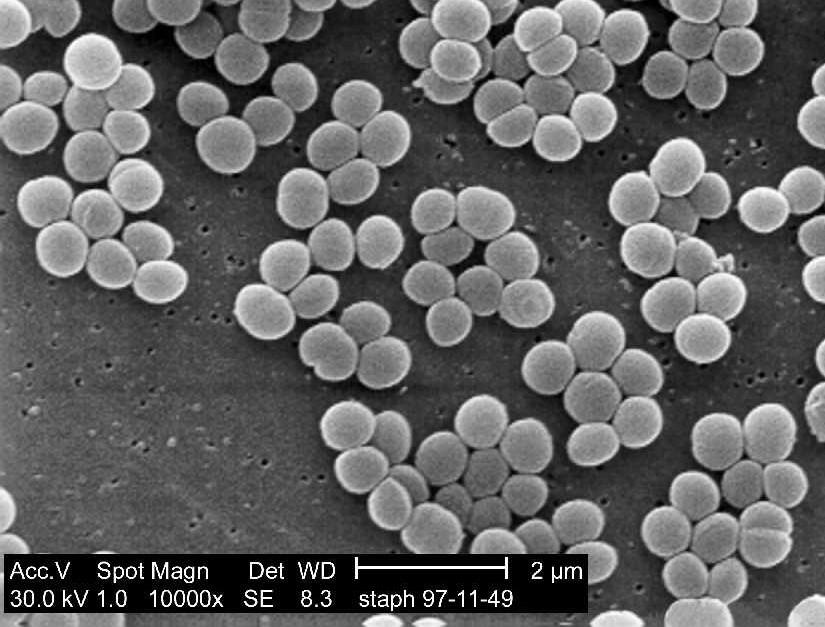 http://www.answers.com/topic/staphylococcus-aureus-01-jpg Příběh druhý Studentka P. Z. je nervózní: opět na ni přišly její dny.