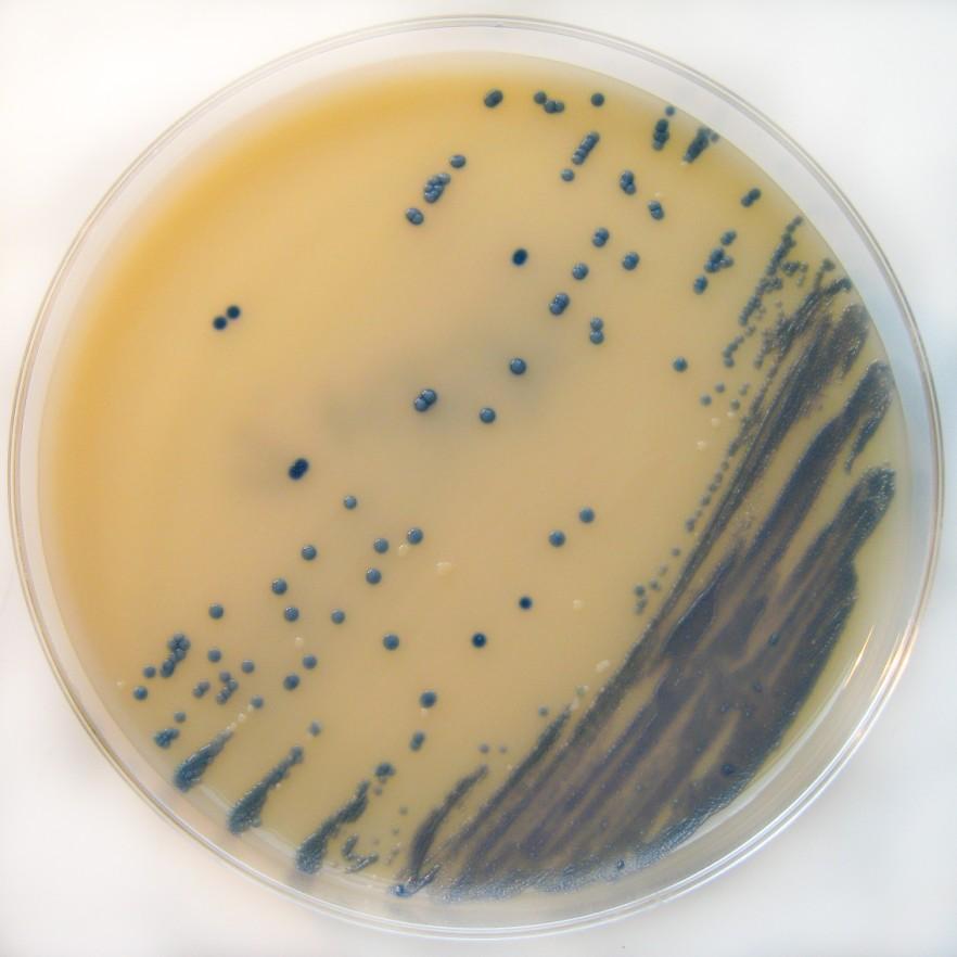 MRSA a jejich detekce MRSA půda chromogenní půda