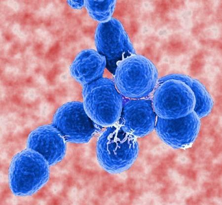 http://contanatura.net/arquivo/streptococcus%20pneumoniae.jpg Příběh čtvrtý Paní Božena, důchodkyně nemá slezinu vyňali jí ji před léty po autonehodě.