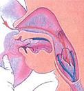 obratle kraniálněji (C 2 až C 4), epiglottis se dotýká