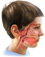 ) Pars nasalis pharyngis tonsilla pharyngea Novorozenec