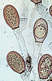 rhizomycelium eukarpická polycentrická stélka