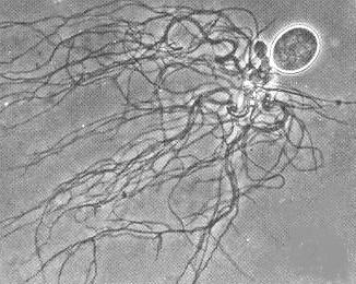 Neocallimastix frontalis trvalá