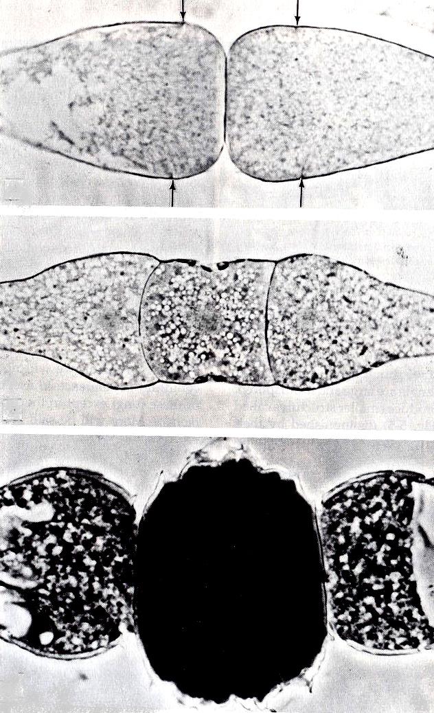 ZYGOMYCETES