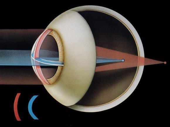 Validity of the method for determining ocular astigmatism (clock dial method, phoropter, Jackson cross cylinder) Bc. Barbora Dvořáková, Mgr.