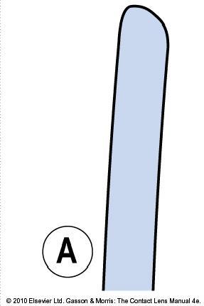 (The shape of the lens should be as similar to the shape of cornea as possible, because it provides the best stability.