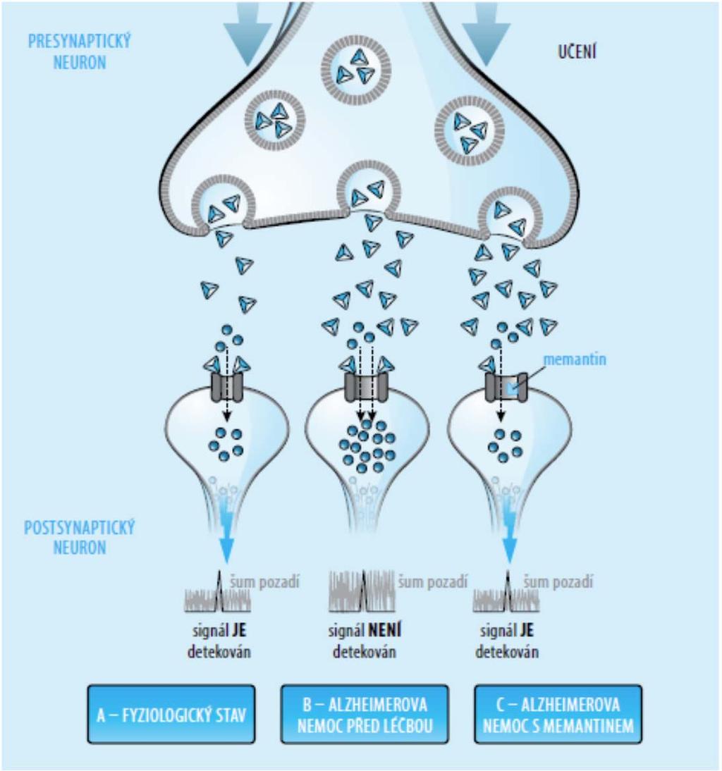 Memantin mechanismus účinku Bartoš A. Léčba Alzheimerovy nemoci.