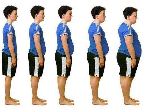 Obezita Obezita (adipozita,