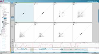 Holtery EKG 11 PADSY-Holter jednoduché ovládání a kvalitní EKG křivka Holterovský systém PADSY-Holter se vyznačuje svou modulární koncepcí,