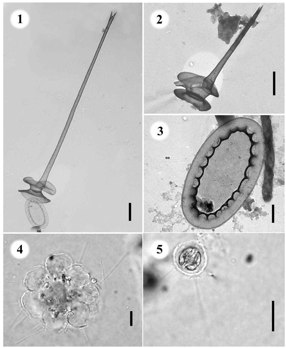 1.-5. Chrysosphaerella brevispina - 1.-3. ostny a šupiny, 1., 2. úsečky 1 µm, 3.