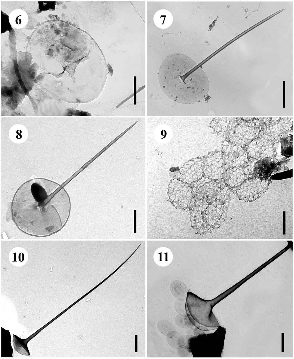 6. Paraphysomonas gladiata ostnová šupina s krátkým osténkem, úsečka 1 µm. - 7. Paraphysomonas imperforata ostnová šupina, úsečka 1 µm. 8.