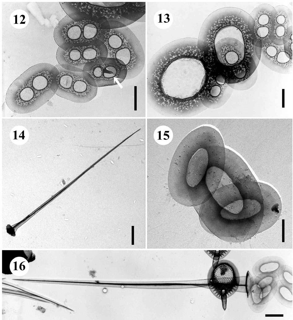 12.-14. Spiniferomonas serrata 12. šupiny se dvěma lakunami (angl. double lacunae scales), šipka označuje uzlinu či výrůstek na můstku mezi lakunami (angl. nodule or rod on bridge), úsečka 0,5 µm, 13.
