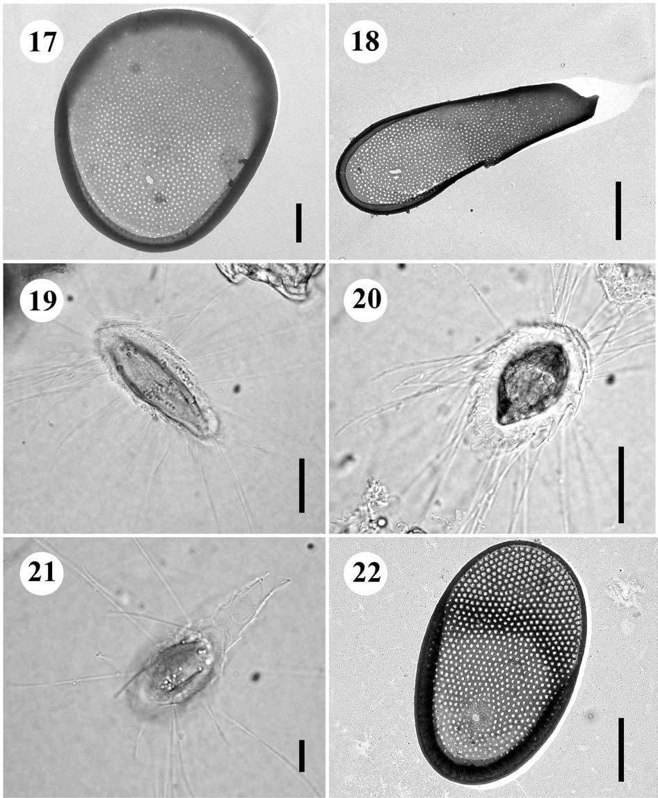 17.-21. Mallomonas caudata 17. šupina, úsečka 1 µm, 18.