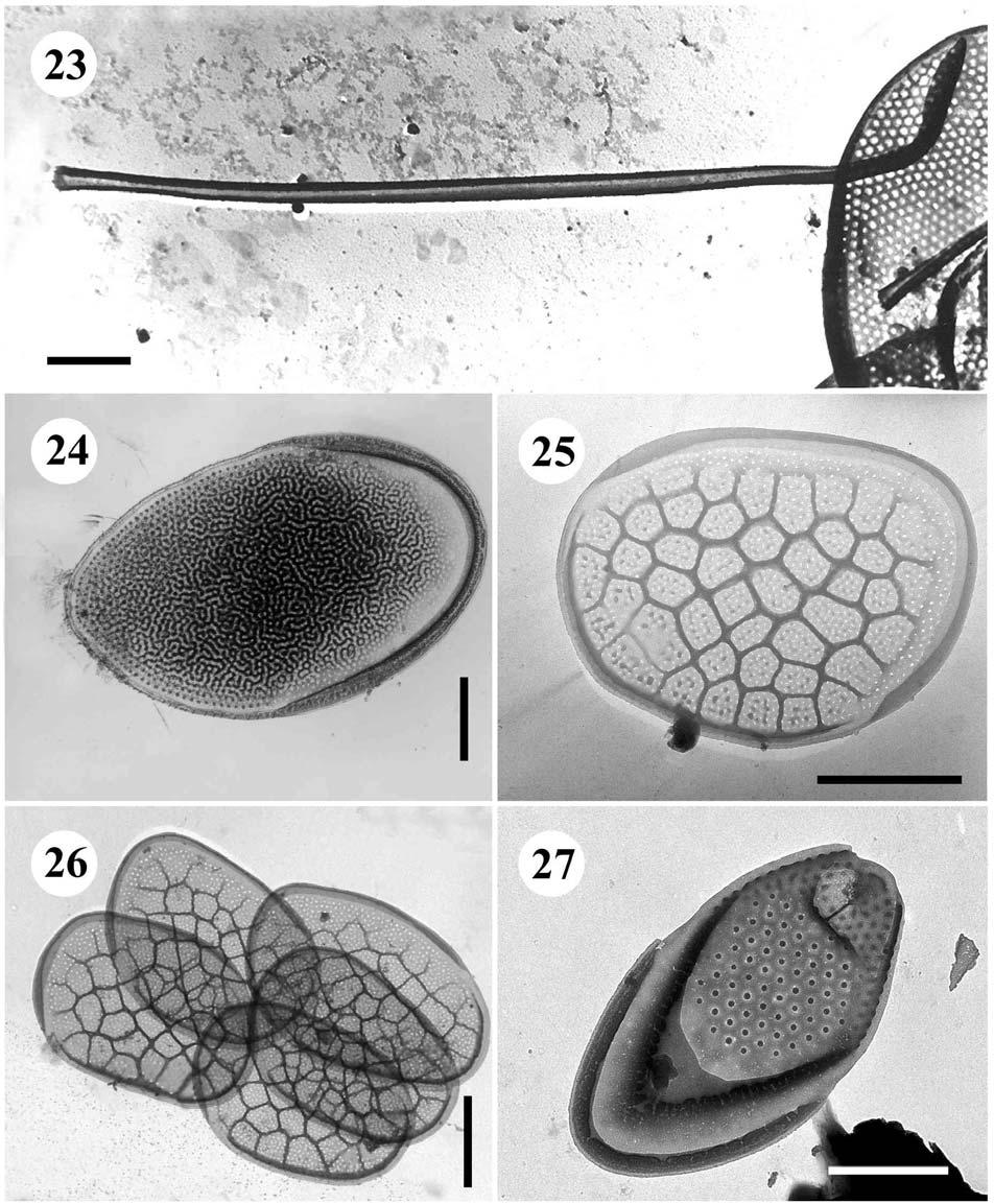 23. Mallomonas matvienkoae var. matvienkoae f. matvienkoae osten, úsečka 1 µm. - 24.