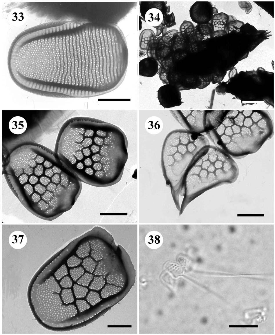 33. Mallomonas transsylvanica - šupina, úsečka 1 µm. 34.-38. Mallomonas punctifera var. punctifera 34.