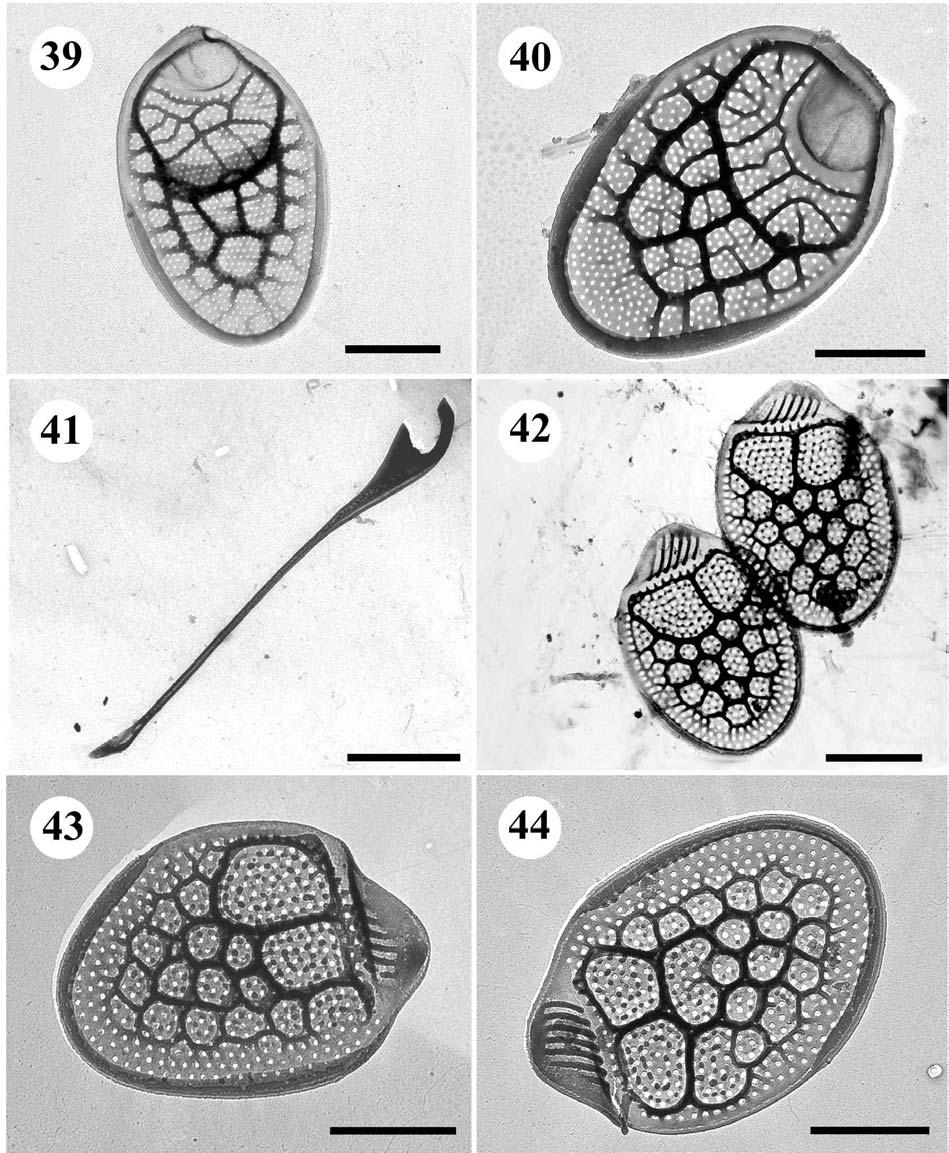 39.-41. Mallomonas heterospina 39.,40. šupiny, úsečky 1 µm, 41.