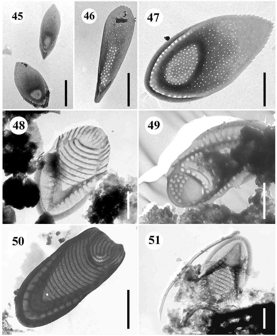 45.-47. Mallomonas akrokomos tělové a posteriorní šupiny, 45. úsečka 2 µm, 46., 47. úsečky 1 µm. 48.,49. Mallomonas striata 48. šupina, 49.