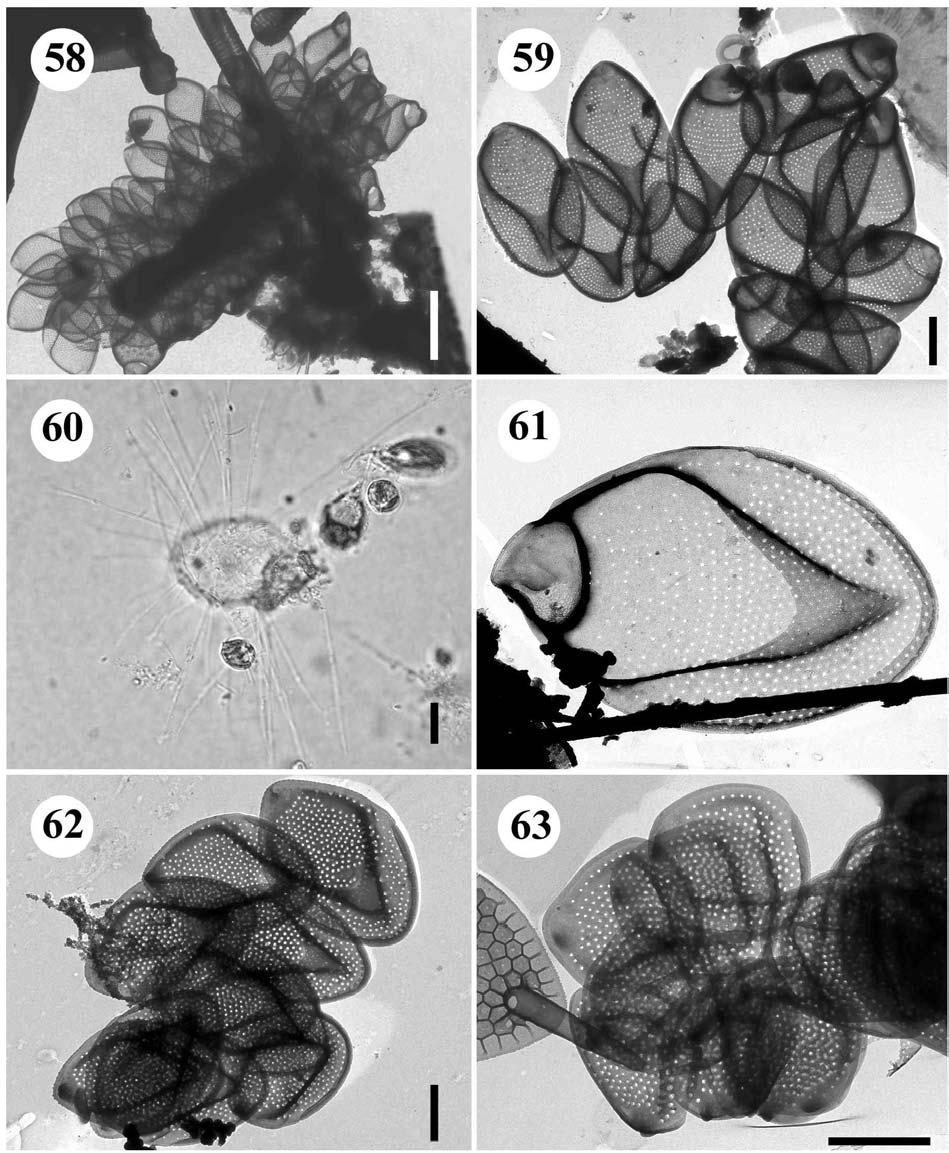 58.-61. Mallomonas elongata 58. buňka, úsečka 5 µm, 59. skupina šupin, úsečka 2 µm, 60.