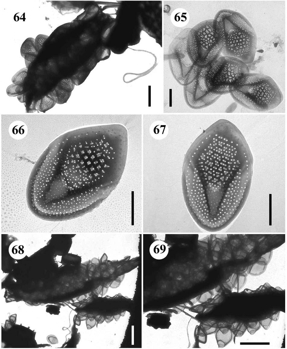 64.-67. Mallomonas sp. 1. - 64.buňka, úsečka 2 µm, 65.-67. šupiny, úsečky 1 µm. 68.-69.