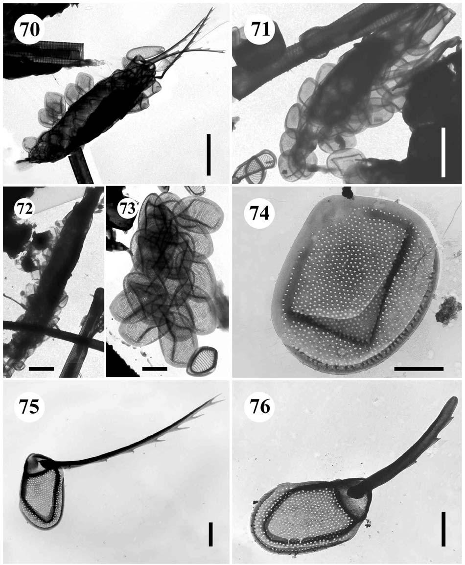 70.-76. Mallomonas sp. 2. 70.-72. buňky, úsečky 5 µm, 73.