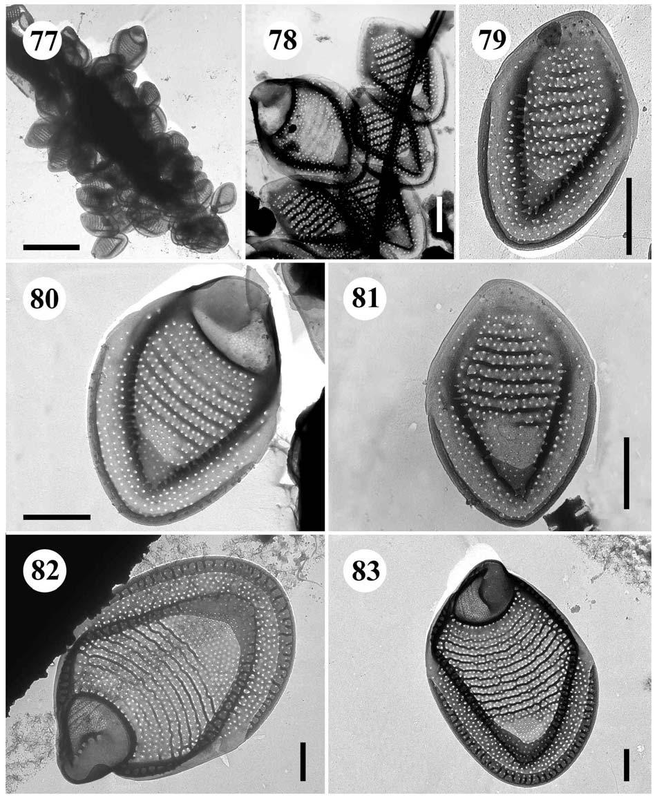 77.-81. Mallomonas trummensis 77. buňka, úsečka 5 µm, 78.