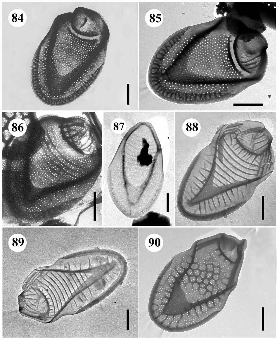 84.-85. Mallomonas intermedia var. intermedia šupiny, úsečky 1 µm. - 86., 87. Mallomonas costata šupiny,. úsečky 1 µm. - 88.