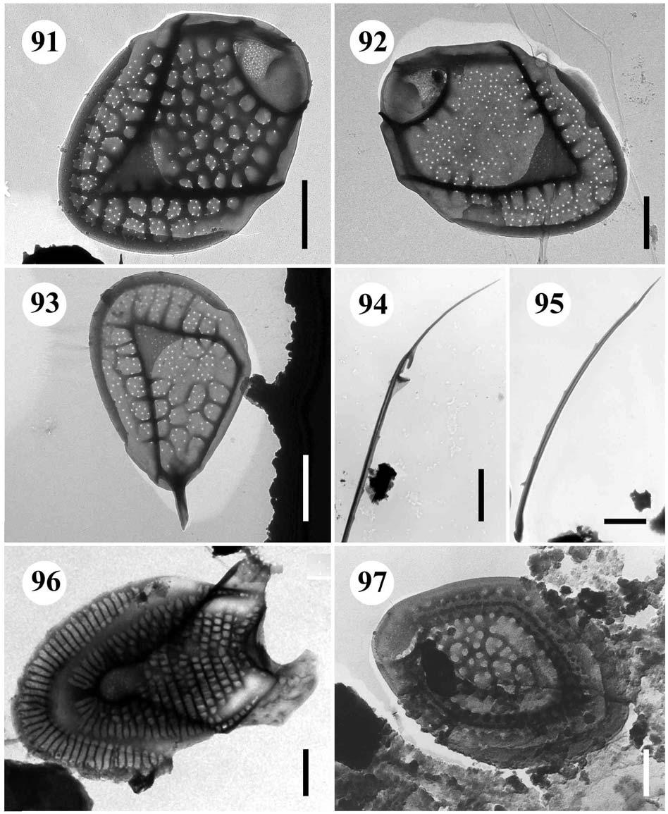 91.-95. Mallomonas crassisquama var. crassisquama 91. tělová šupina, 92. tělová šupina s redukovanou retikulací, 93. posteriorní šupina, úsečky 1 µm, 94.