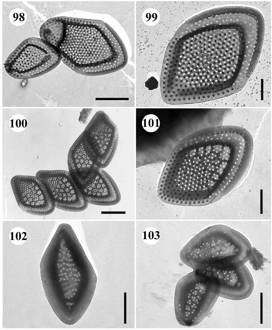 98.-101. Mallomonas annulata 98. apikální šupina s dómem a menší posteriorní šupina, úsečka 1 µm, 99. tělová šupina bez retikulace, úsečka 0,5 µm, 100.-101. tělové šupiny s vyvinutou retikulací, 100.