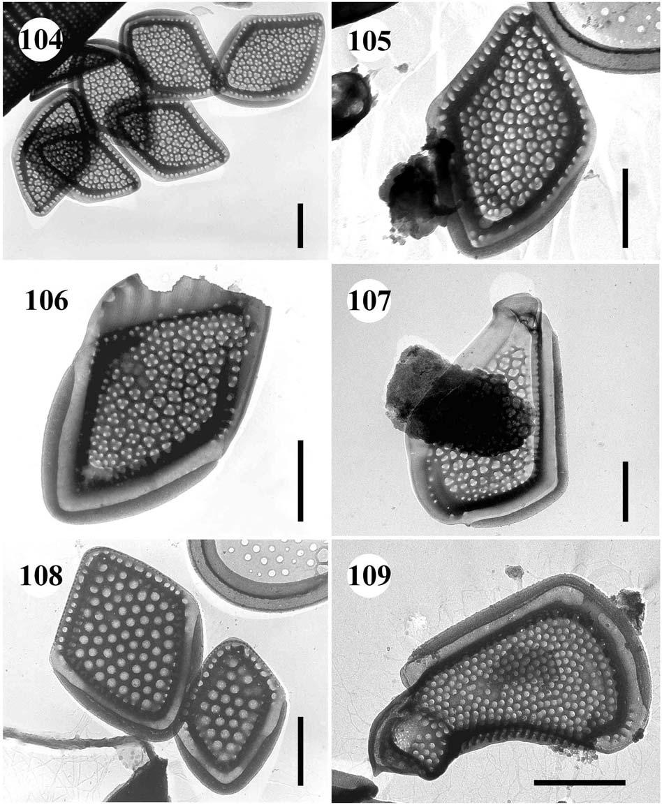 104.-105. Mallomonas pumilio var. silvicola šupiny, úsečky 1 µm. 106.-107. Mallomonas alata f. alata 106. tělová šupina, 107. apikální šupina, úsečky 1 µm. 108.