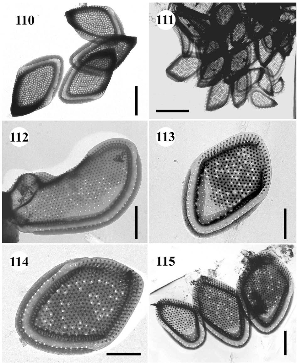 110.-111. Mallomonas prora 110. tělové šupiny, úsečka 1 µm, 111. zadní část buňky, úsečka 2 µm. - 112.-115. Mallomonas mangofera var.