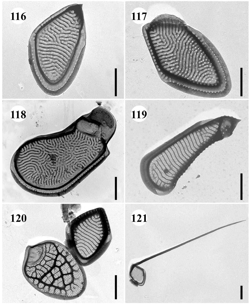 116.-118. Mallomonas schwemmlei 116., 117. tělové šupiny, 118. apikální šupina, úsečky 1 µm. - 119.-121. Mallomonas doignonii var.