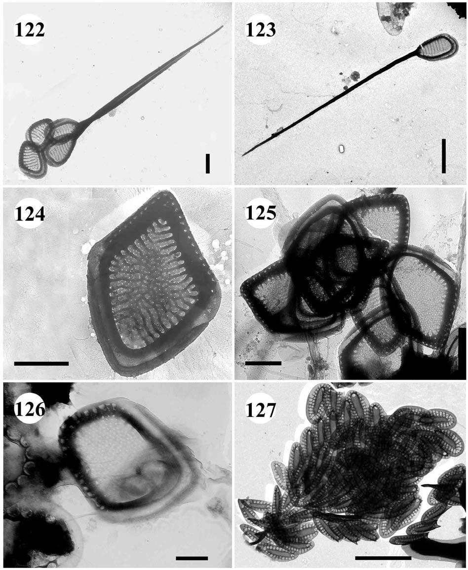 122.-123. Mallomonas doignonii var. doignonii 122. tělové a posteriorní šupiny s ostnem, úsečka 1 µm, 123. posteriorní šupina s ostnem, úsečka 2 µm. 124. Mallomonas torquata f.
