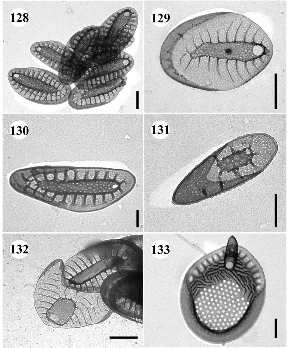 128.-132. Synura petersenii 128.-129. tělové šupiny, úsečky 1 µm, 130.-131.
