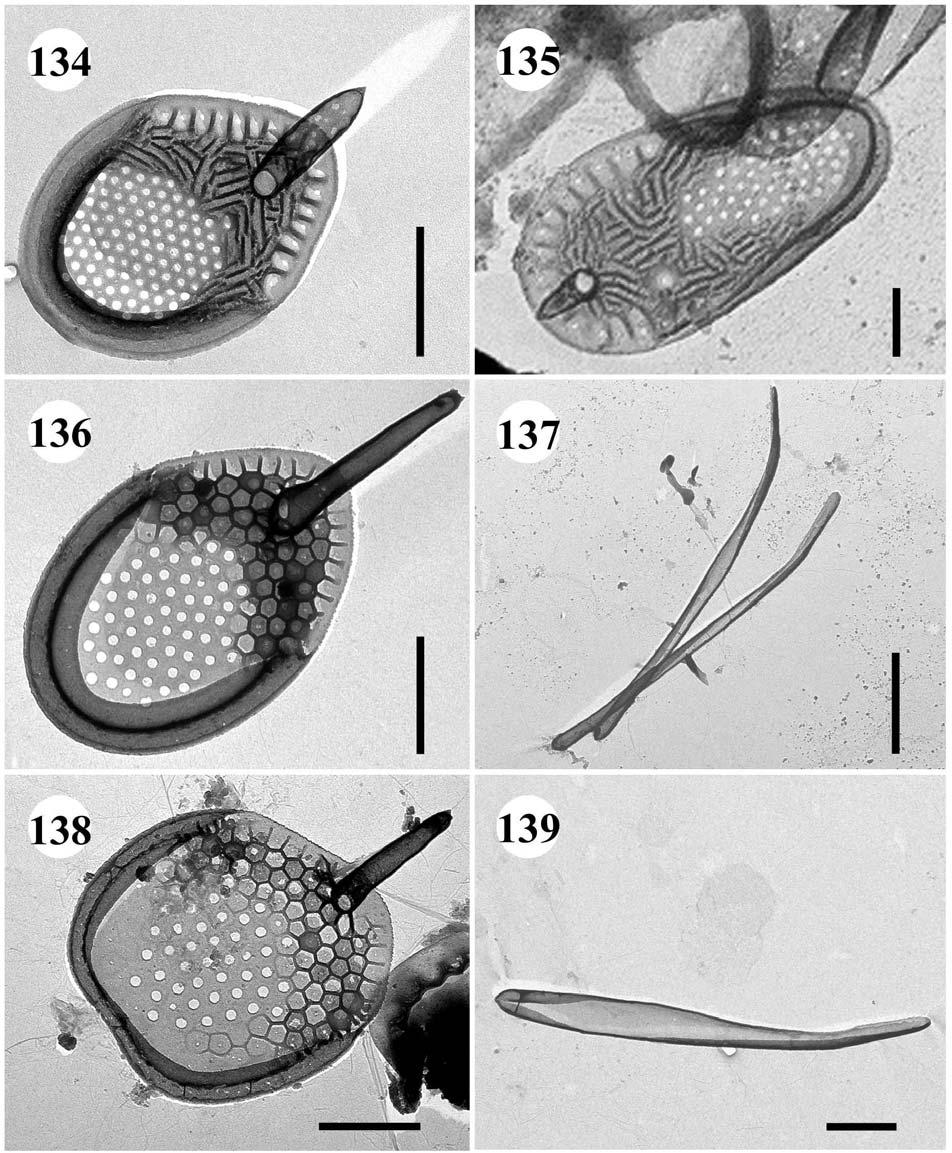 134.-135. Synura echinulata 134. tělová šupina, úsečka 1 µm, 135. šupina s ostnem ze zadní části buňky, úsečka 0,5 µm. 136.-139.