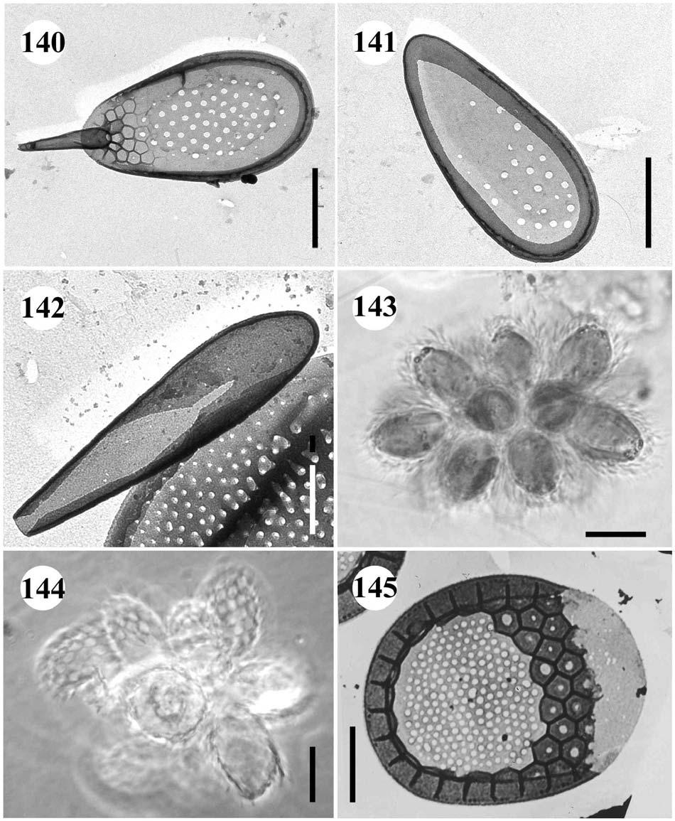 140.-141. Synura spinosa 140. šupina s ostnem ze zadní části buňky, 141. posteriorní šupina, úsečky 1 µm. - 142. Synura curtispina?