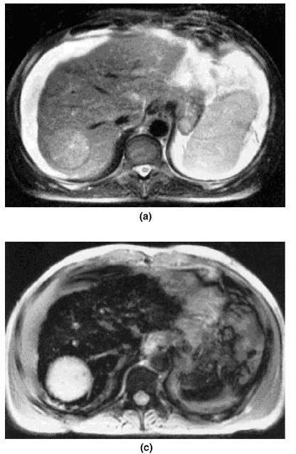 hoří diagnostikují léčí Magnetická