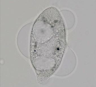 Antimikrobiální nanomateriály na bázi nanočástic Ag Antibakteriální