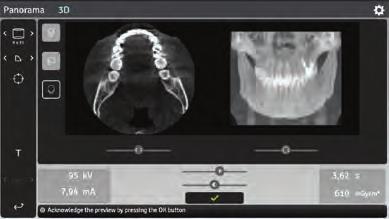 Nástroje pro profesionální lékaře. SMARTVIEW 2.0 s novou úrovní kontroly a flexibility. Pomocí OP 3D lze snadno a přesně ovládat umístění pole vidění.